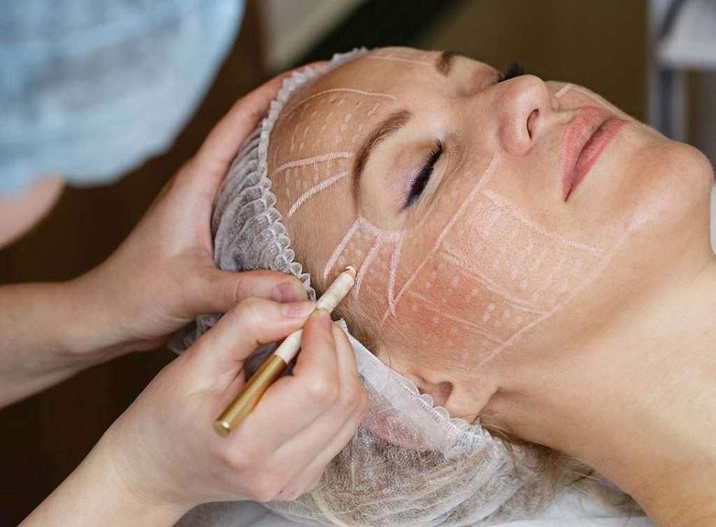 Face lift surgery in Islamabad