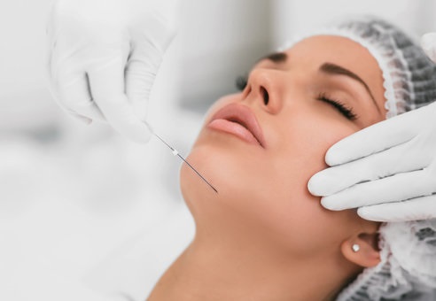 Cost of Thread Lift Treatment in Islamabad