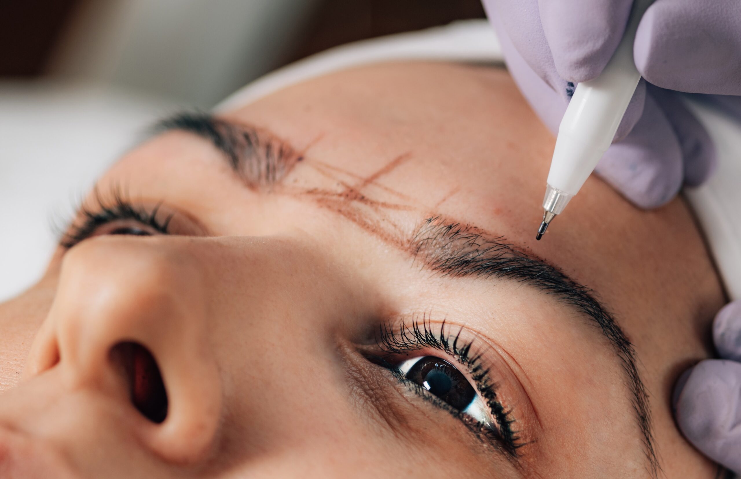 Eyebrow Transplant In Islamabad