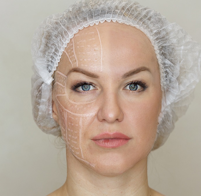 Facelift clinic Rawalpindi