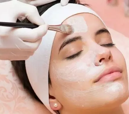chemical peels in Islamabad