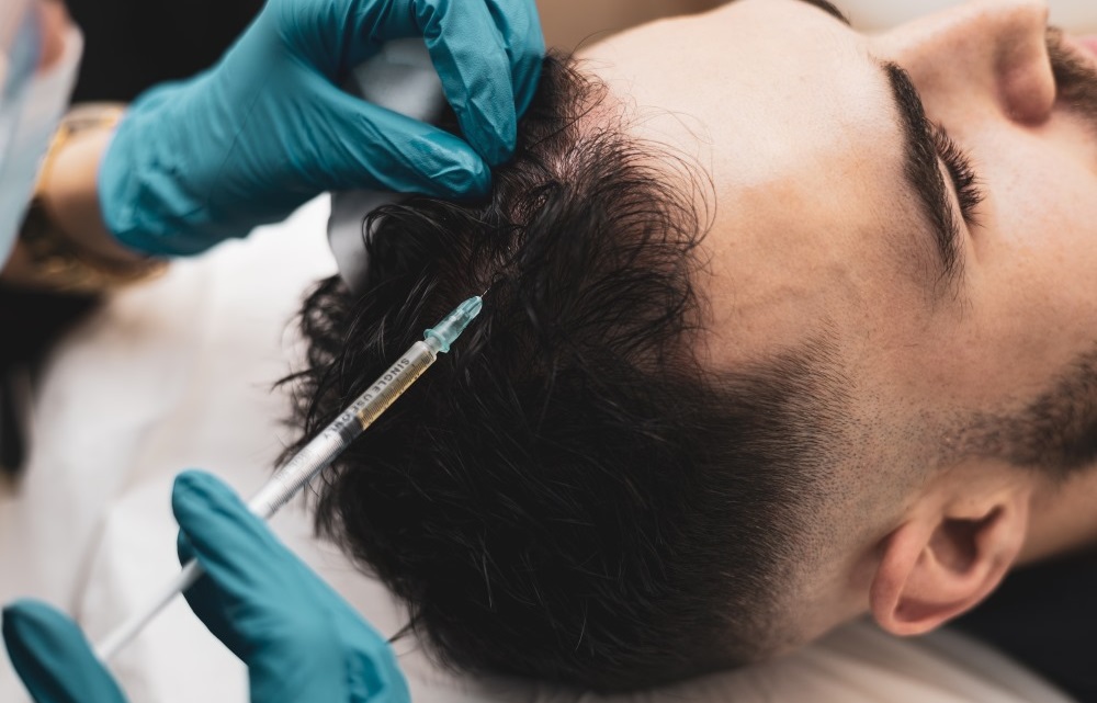 Hair Fillers Treatment in Islamabad