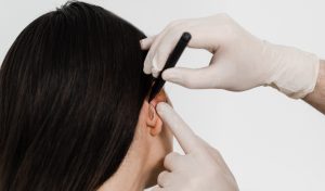 otoplasty in Islamabad Pakistan