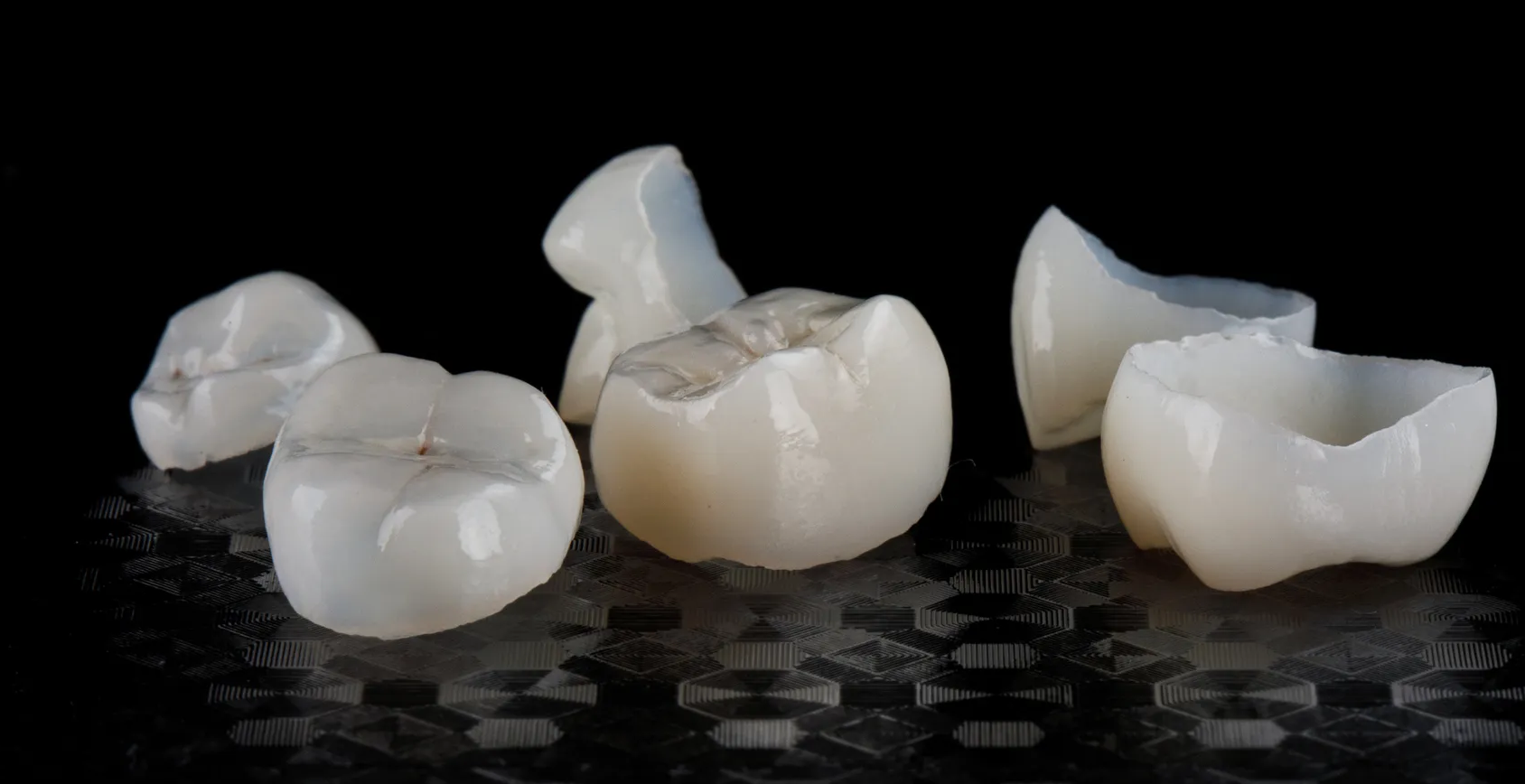 Dental Crown in Islamabad