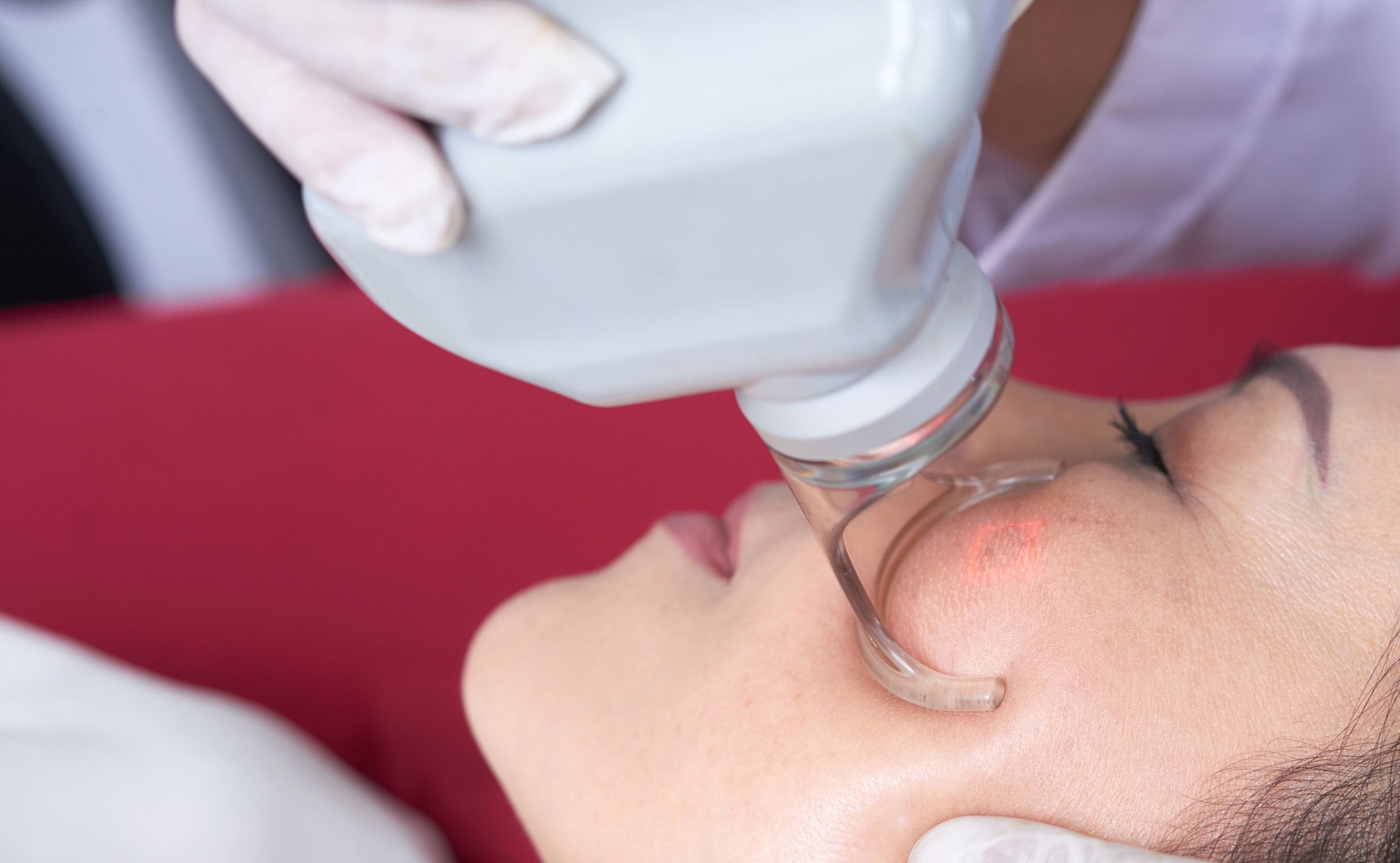 CO2 laser for acne scars Price in Pakistan