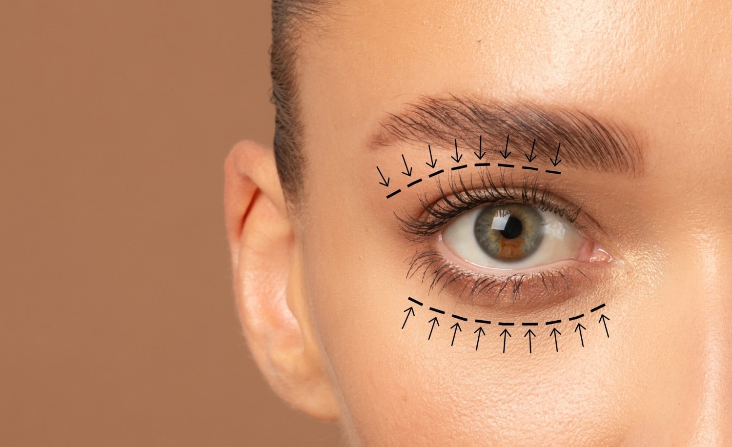Lower Eyelid Surgery Cost in Islamabad