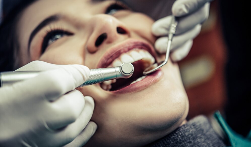 How Much Teeth Filling Price in Islamabad