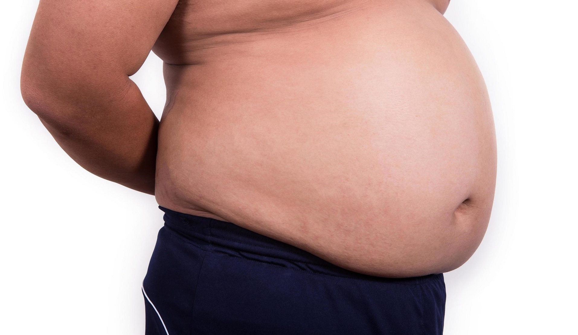 Belly Fat Removal Surgery Cost in Islamabad