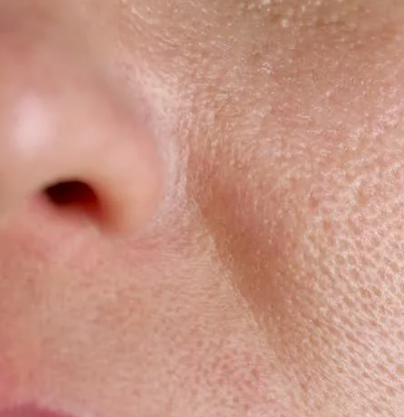 will i get darker if i stop taking glutathione Immunocal: Clinically Proven Glutathione Boost I Immunotec main image 1