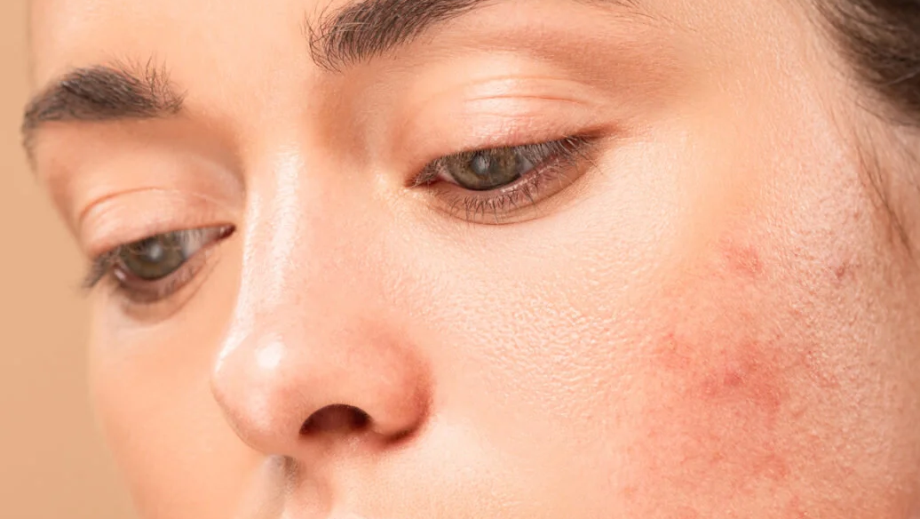 if i stop taking glutathione will my skin get darker Will I get darker if I stop taking glutathione?