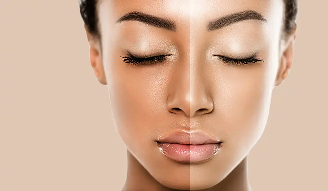 Glutathione Injections in Islamabad | Skin Whitening Injections Glutathione Injections in Islamabad | Skin Whitening Injections