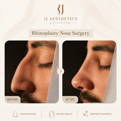 Best Rhinoplasty Clinic In Islamabad Pakistan