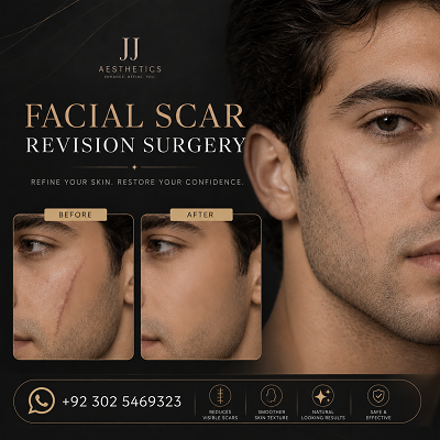 Facial Scar Revision Surgery in Islamabad Rawalpindi & Pakistan